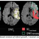 Voxel-based analysis of infarct growth / reversal over time
