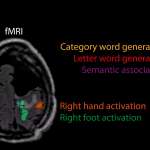 Postoperative MRI.jpg