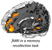fMRI in a memory  recollection task