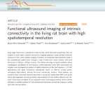 Functional ultrasound imaging of intrinsic connectivity in the living rat brain with high spatiotemporal resolution