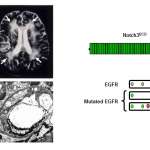 Neuroimaging, vascular and molecular features of CADASIL 