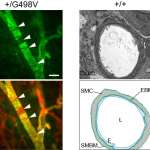 Défauts des cellules musculaires lisses artérielles chez les souris mutantes Col4a1 